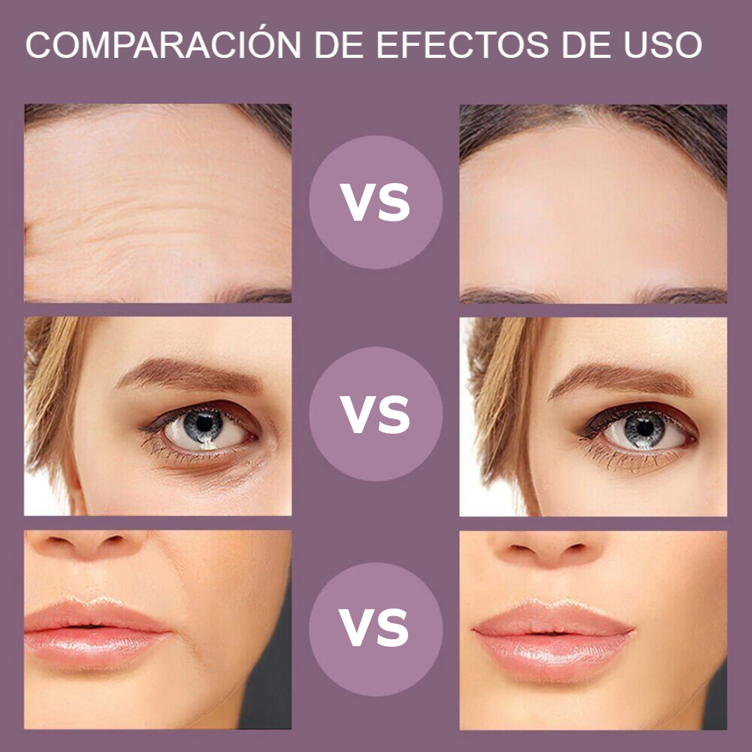 Dispositivo de Rejuvenecimiento Facial