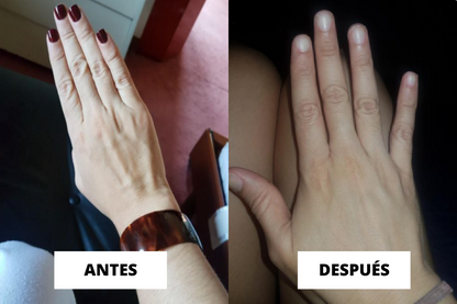 Removedor de Esmalte Instantáneo