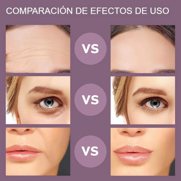 Dispositivo de Rejuvenecimiento Facial, imagen 3